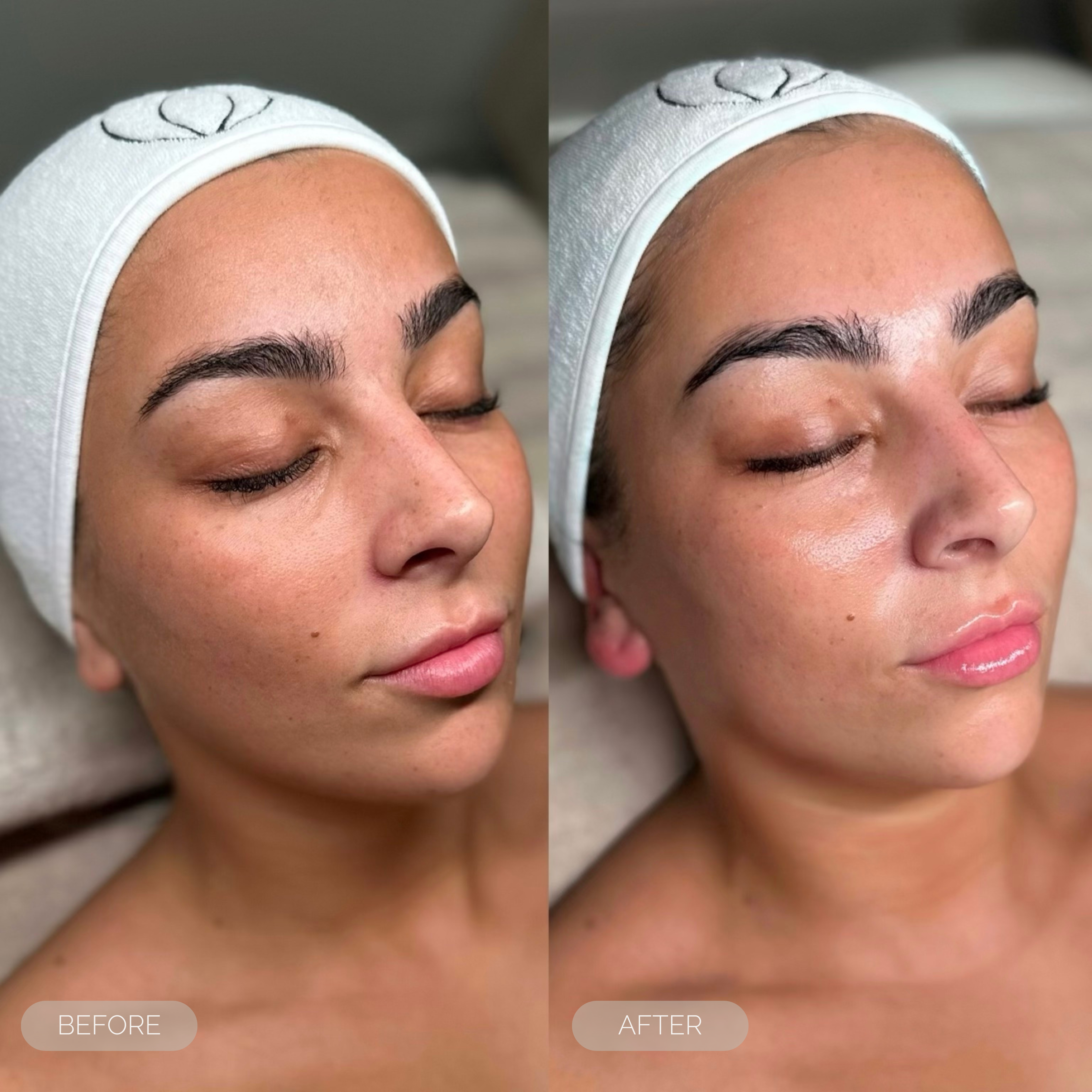 fresh inc medispadull skin treatments dundee scotland 