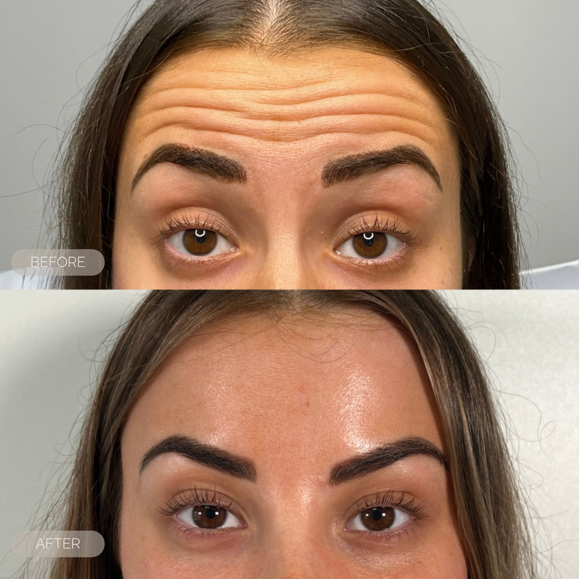 Before and after comparison of a woman's face with a focus on skin texture and expression.
