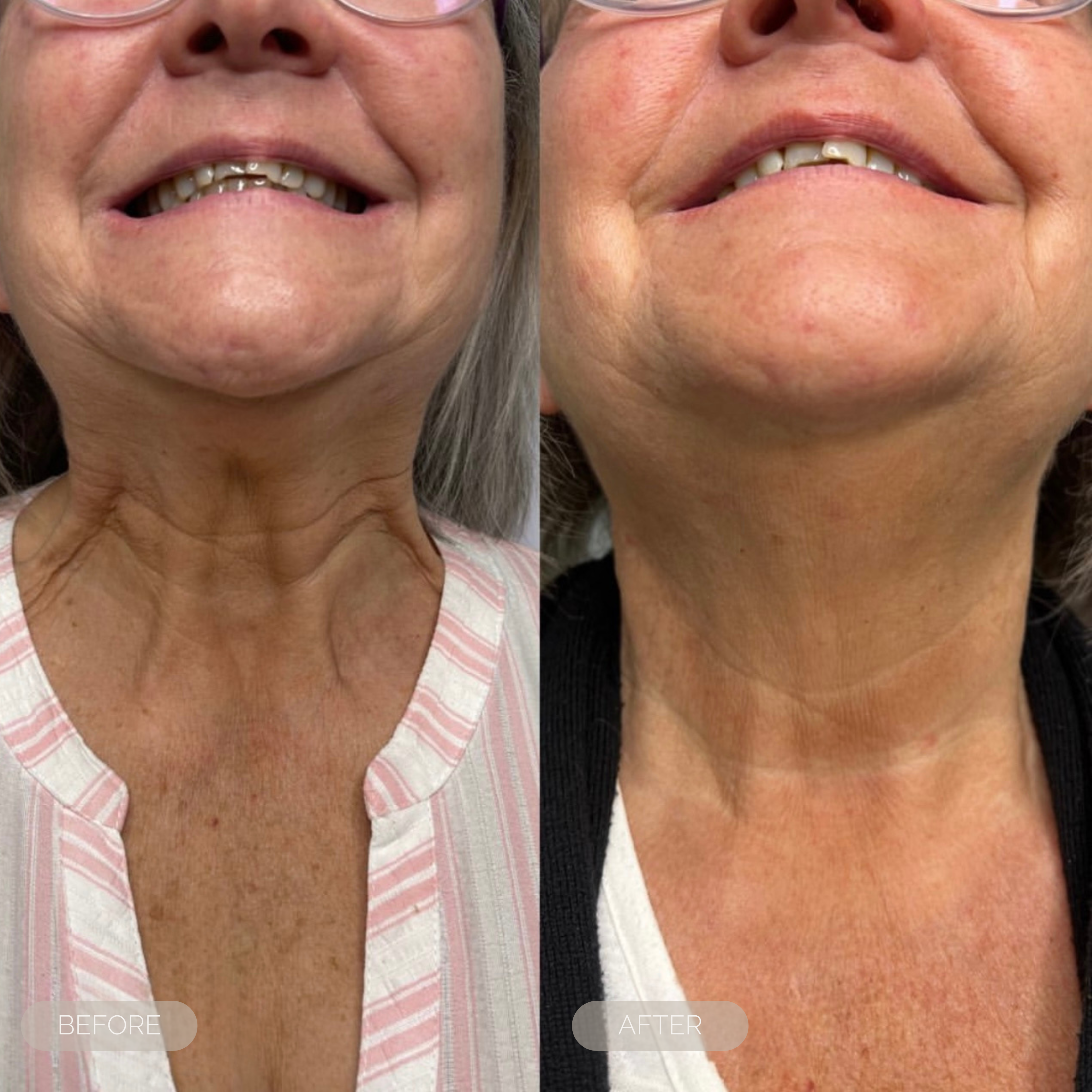 fresh inc medispa shop skin neck treatments dundee scotland 