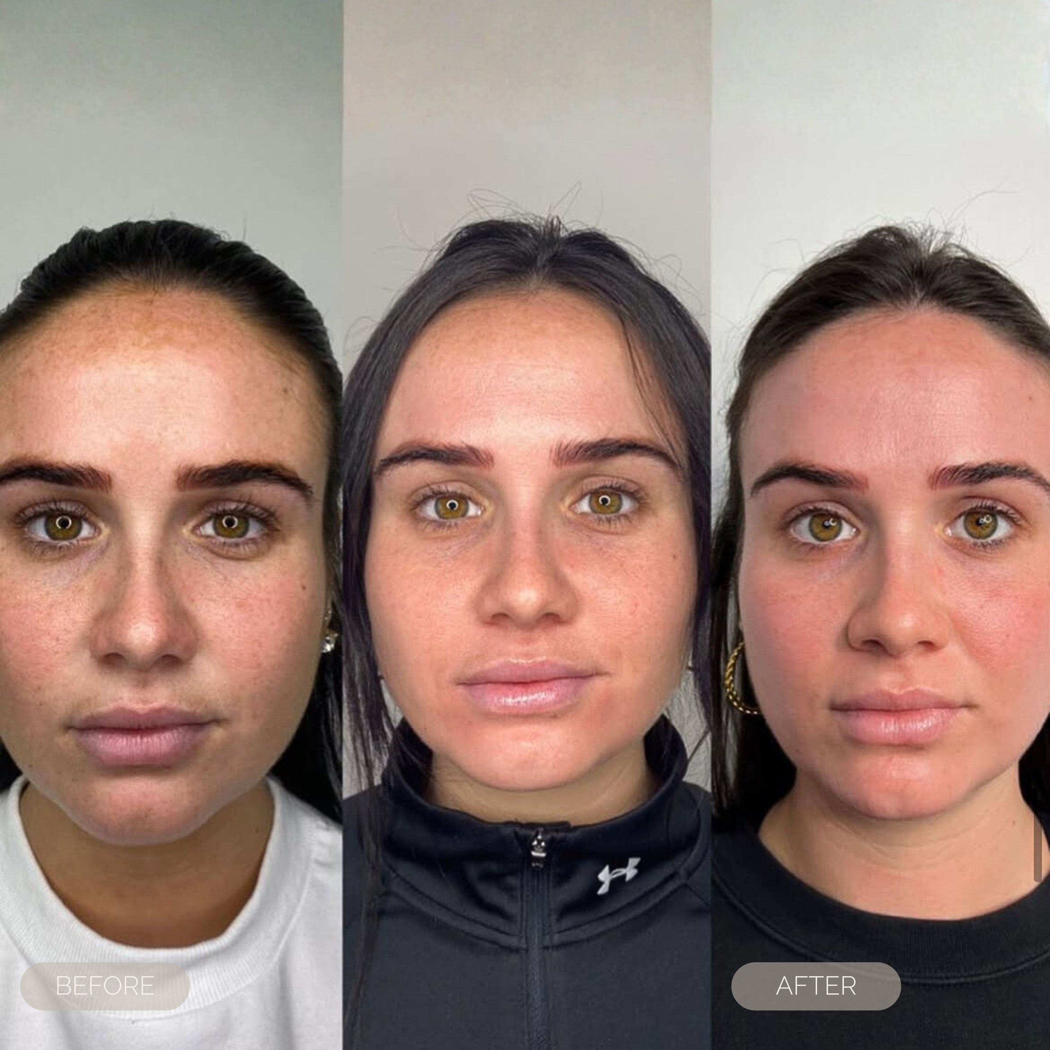 fresh inc medispa pigmentation treatments dundee scotland 