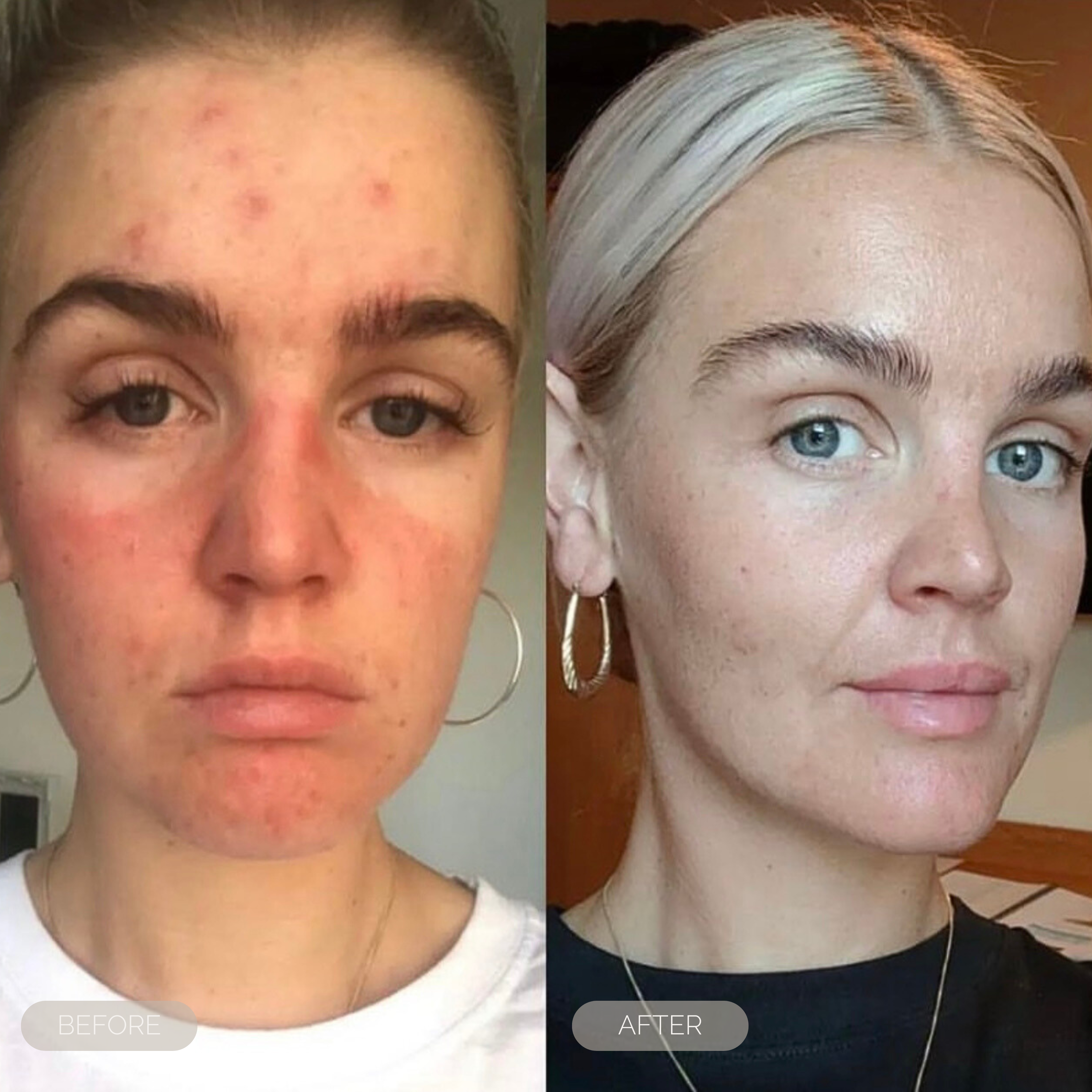 fresh inc medisparedness in skin treatments dundee scotland 